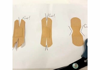 切れ込みを入れれば剥がれにくい!? 救急医が教える「手指の傷にばんそうこうを貼るコツ」が勉強になる