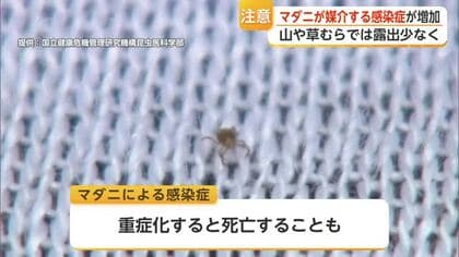 アウトドアで注意すべきマダニ感染症 県内でSFTS・日本紅斑熱感染など相次ぐ【佐賀県】