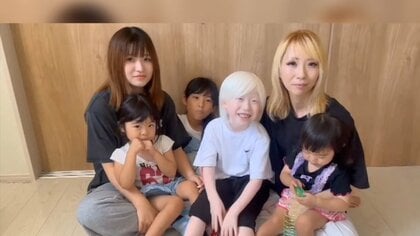 「白い髪も個性と胸を張って！」“ありのまま”を投稿し難病への理解広めたい【アスヨク！】