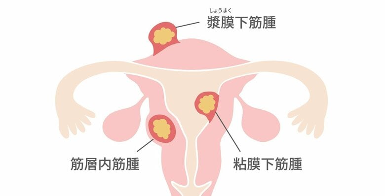 （画像はイメージ）