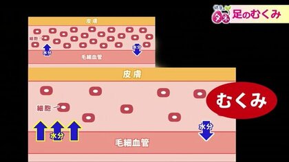 「場合によっては即死も」足のむくみが引き起こす“健康リスク”と予防法を医師が解説【福井発】