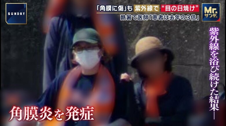 猛暑で「目の日焼け」に…紫外線浴びて角膜に“傷”　視力低下・視界悪化の可能性　さらに「脳の日焼け」で不安や疲労感｜FNNプライムオンライン