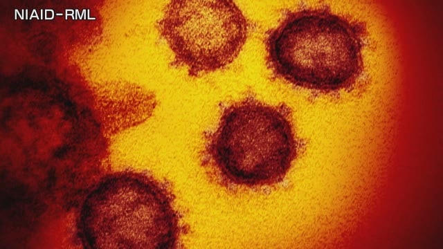 新型コロナ 新たな感染確認は９１人 過去最多と同数 松山市が６割超の５６人 愛媛