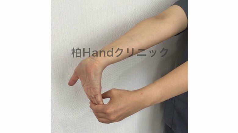 屈筋腱のストレッチはこんな感じ（提供：田中医師）