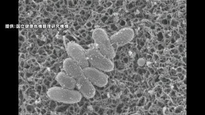 【速報】百日咳・リンゴ病の新規感染者数が再び過去最多に　全国の百日咳感染者数は1週間で3211人　国立健康危機管理研究機構