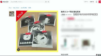 「胎児エコー写真」フリマサイトに出品多数で物議「メルカリ」が出品禁止に…“妊娠詐欺”に悪用のおそれも