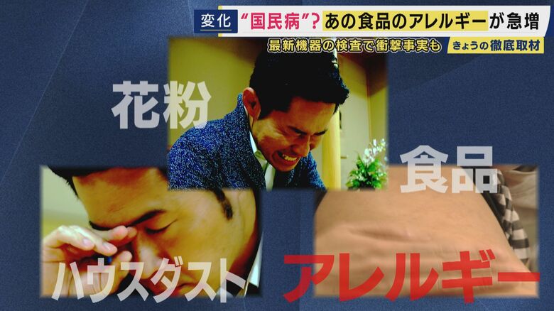「自覚なし」でもアレルギーに　2人に1人が抱える時代　ナッツアレルギーは10年で10倍に急増…15分で分かる最新血液検査も｜FNNプライムオンライン