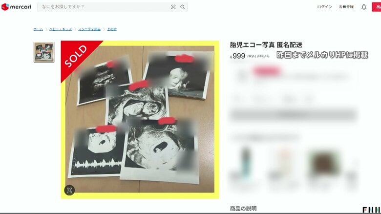 「胎児エコー写真」フリマサイトに出品多数で物議「メルカリ」が出品禁止に…“妊娠詐欺”に悪用のおそれも｜FNNプライムオンライン
