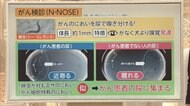 3分でわかるキーワード 実用化「尿1滴でがん検診」