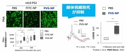 SENTAN Pharma、網膜色素変性症を対象にしたピタバスタチンナノ粒子製剤を開発、第1相医師主導治験を2026年度開始へ
