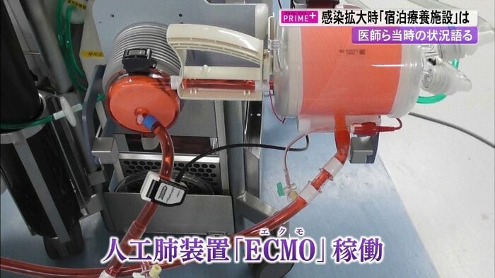 人工肺装置「ECMO」