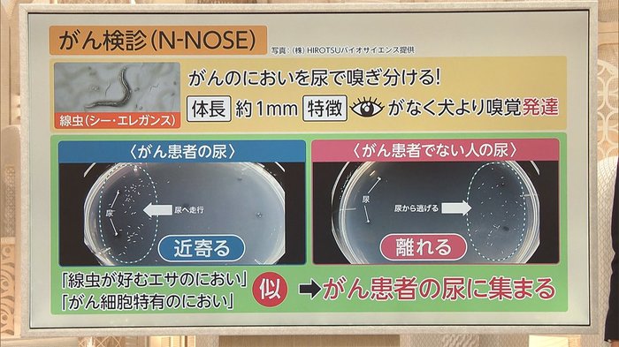 3分でわかるキーワード 実用化「尿1滴でがん検診」