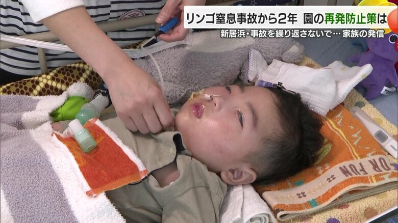 愛媛県新居浜市の保育園で起こったリンゴ窒息事故から２年　意識不明の男児はいま…再発防止誓う園の取り組み【愛媛発】｜FNNプライムオンライン