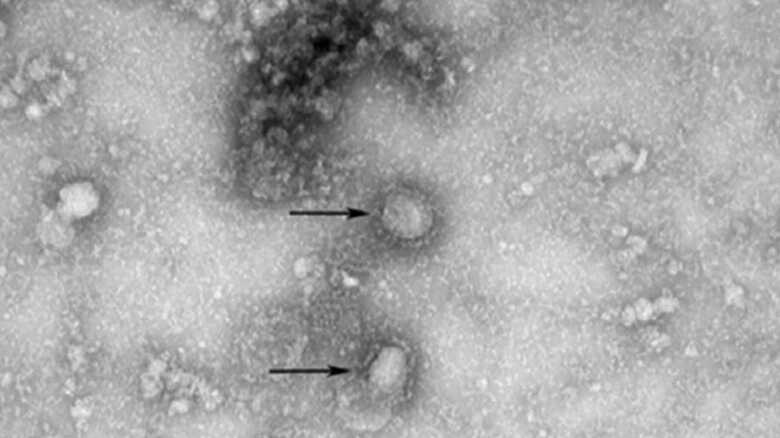 新型コロナウィルス
