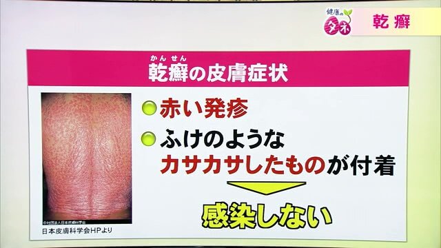 病気への周囲の理解も重要