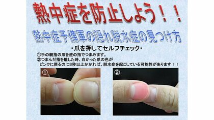 爪を押すだけで“熱中症予備軍”か分かる!? コロナ禍で注意すべき熱中症対策を厚労省に聞いた