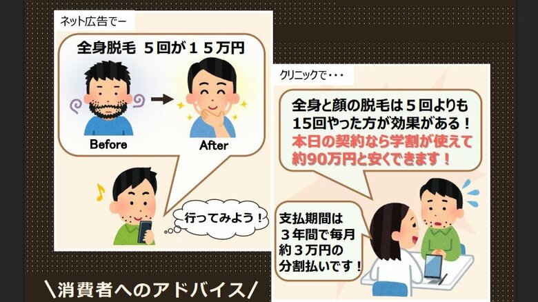 メンズ脱毛5回15万円が90万円の契約に…男性の美容医療トラブル増加で国民生活センターが注意喚起｜FNNプライムオンライン