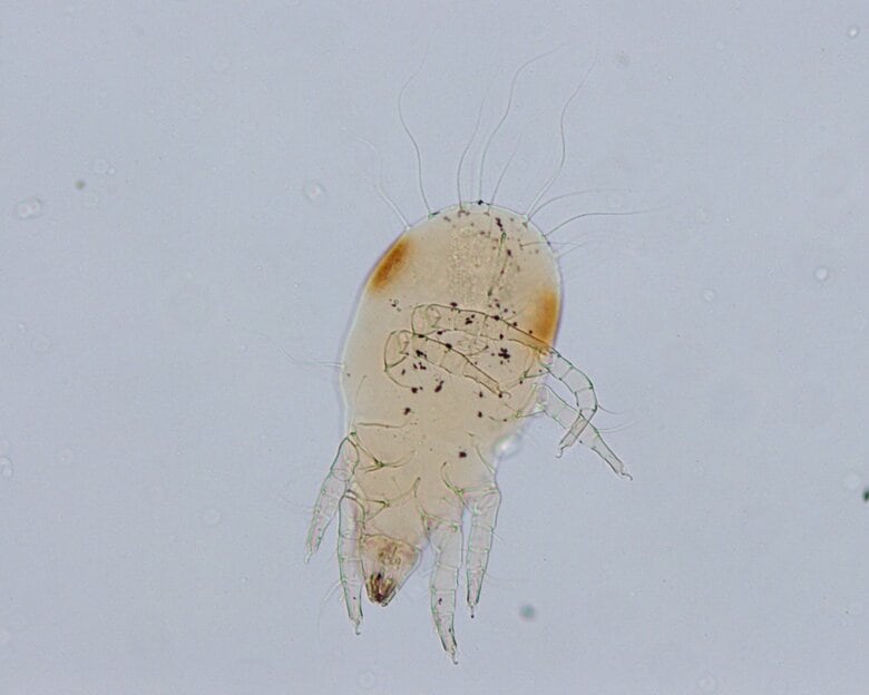 日本の住居にも生息しているケナガコナダニ（画像はイメージ）