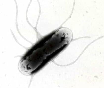 【サルモネラ食中毒】飲食店で食事をした客11人が発症し2人が入院…客や従業員からサルモネラ属菌が検出…3日間の営業停止処分に…ローストビーフや串焼き、刺身など提供〈札幌市保健所〉