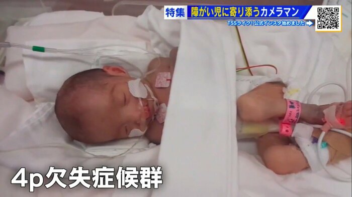 生後まもない頃の梨瑚ちゃん