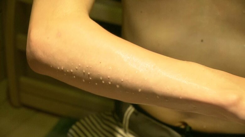 15分ほどすると汗が出てくる