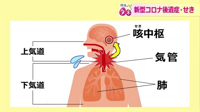 ウイルスがなくなってもせきがでる仕組み
