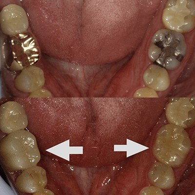 セラミック治療後の口内（提供：アンチエイジングデンタルクリニック恵比寿）