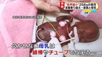 日本の 世界最小の赤ちゃん が退院 すくすくと成長し体重は約12倍に Bbcニュース