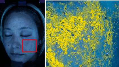にんじんジュースを継続摂取した結果、7人中6人の隠れジミが平均13.4％改善傾向に「β-カロテン継続摂取による隠れジミ対策」モニター調査※1結果を公開