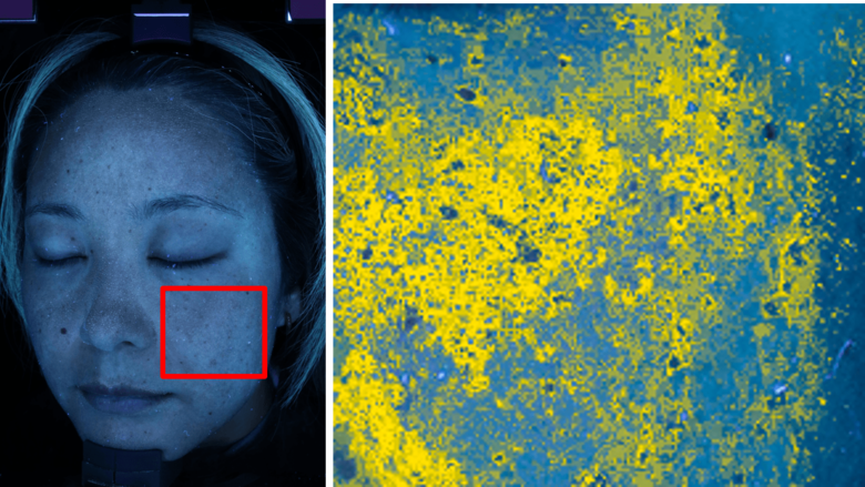 にんじんジュースを継続摂取した結果、7人中6人の隠れジミが平均13.4％改善傾向に「β-カロテン継続摂取による隠れジミ対策」モニター調査※1結果を公開