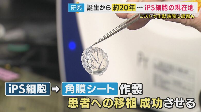 「角膜シート」を作成