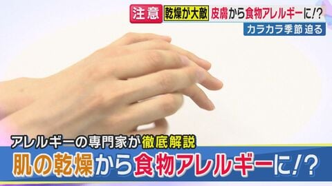 「乾燥肌が“食物アレルギー”の入り口に」？　秋の乾燥シーズンに見落とされる“危険な落とし穴”　突然“魚アレルギー”で突然アナフィラキシーショックの事例も　保湿対策の重傷性などを専門家が解説