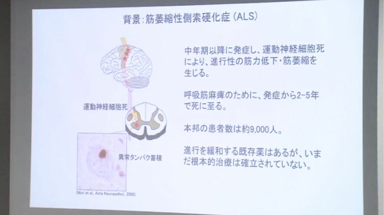 難病「ALS」の説明資料