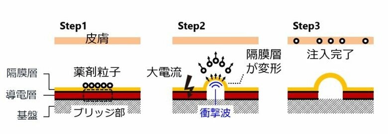 薬剤を打ち出す仕組み（提供：名古屋大学 市原大輔助教）
