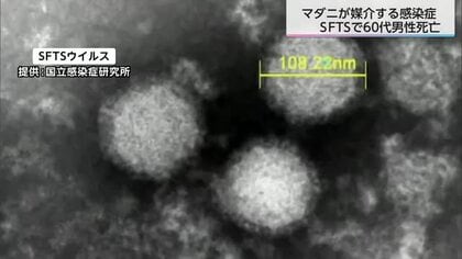 マダニ媒介の感染症「SFTS」で60代男性が死亡　県が屋外作業時の対策と肌の露出を避けるよう呼びかけ