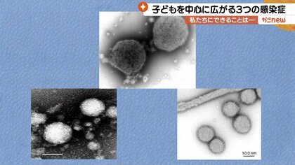 鹿児島県内で増加する3つの感染症…警報・注意報の発令相次ぐ「親が子の重症化を見逃さない」ことが重要【鹿児島発】