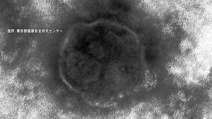 無料で“はしか”の予防接種　利用できる補助とは