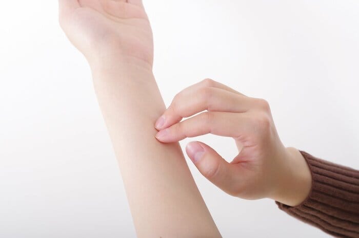 肌に合うかどうか確認を（画像はイメージ）