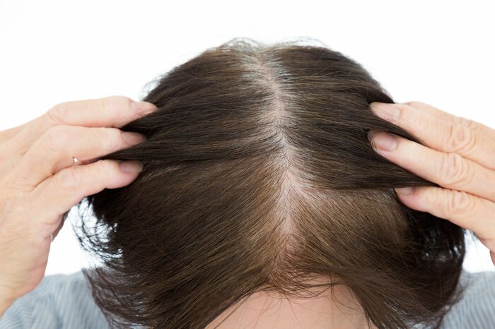 プリン状態を気にする人は多い（画像はイメージ）