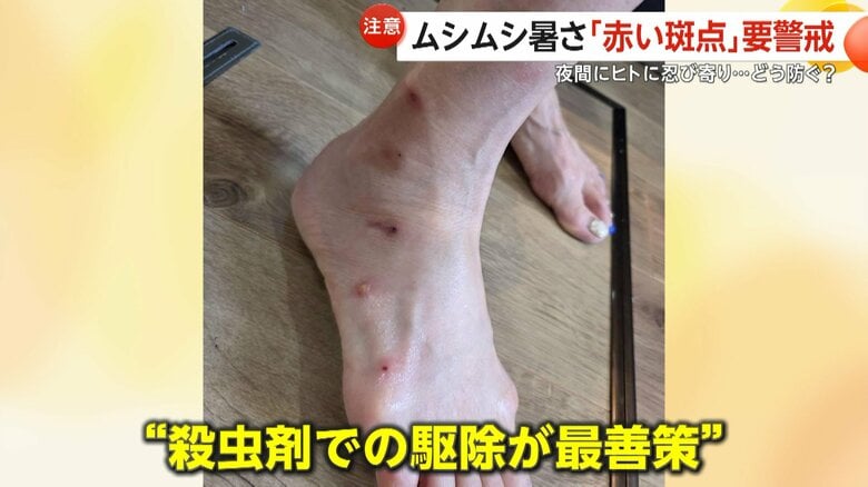 8月にかけて急増するため、見つけたら殺虫剤で駆除するのが最善策
