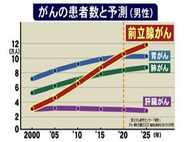 急増『前立腺がん』… 2020年以降“1番多いがん”と予測 その発見と治療法は