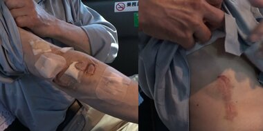 「あー殺すんだなと思った」暴走車に襲われた男性語る 車が向かってきた瞬間