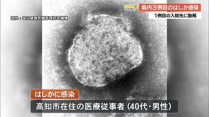 【高知】県内で『はしか』3例目、高知市の40代医療従事者　1例目患者の入院先に勤務も接触なし