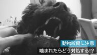 動物に噛まれたら…最悪死に至るケースも　 原因の9割は犬・重症化しやすい猫… 救命医に聞いた対処法【新潟発】