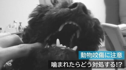 動物に噛まれたら…最悪死に至るケースも　 原因の9割は犬・重症化しやすい猫… 救命医に聞いた対処法【新潟発】