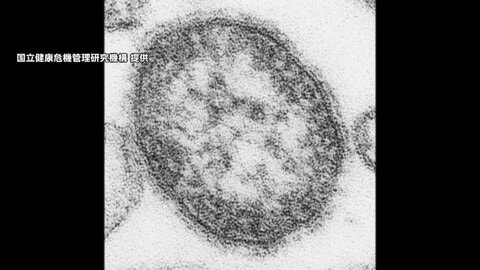 はしかの感染拡大　4月中旬時点で去年1年を上回る　厚生労働大臣がワクチン接種を呼びかけ