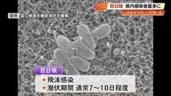 百日咳の感染者　過去最多196人　【高知県】予防心がけ、ワクチン接種も検討を