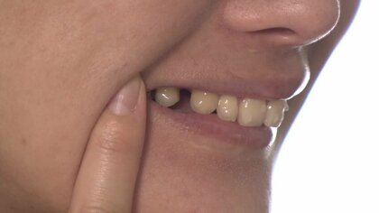 「真実を暴いて」歯科矯正“モニター商法”の患者らが告訴状を提出　クリニック運営会社の驚くべき“音声データ”も入手