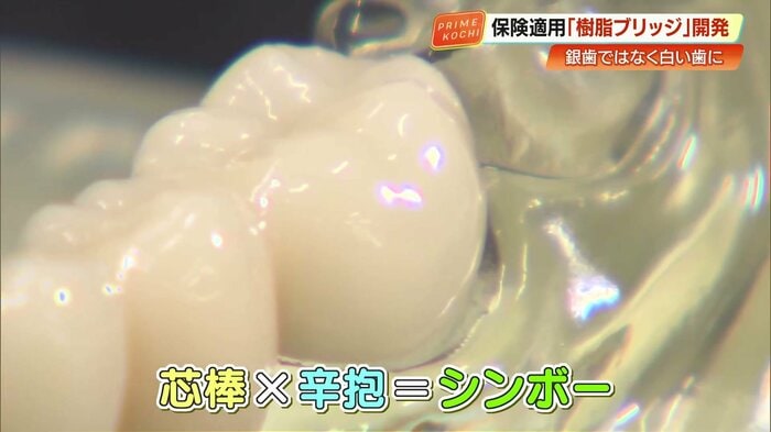 「シンボー」の由来