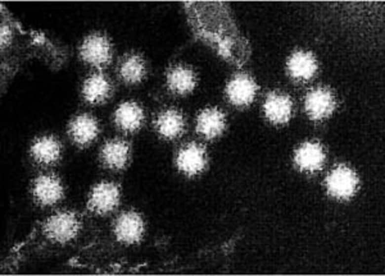 【原材料がノロウイルス汚染か】居酒屋の忘年会で『集団食中毒』20～60代の男女16人に下痢や腹痛などの症状―店員からウイルス検出なし”十分な加熱”なく食事提供か〈北海道北見市〉｜FNNプライムオンライン